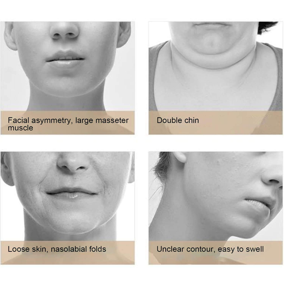 Chin Lifting Device