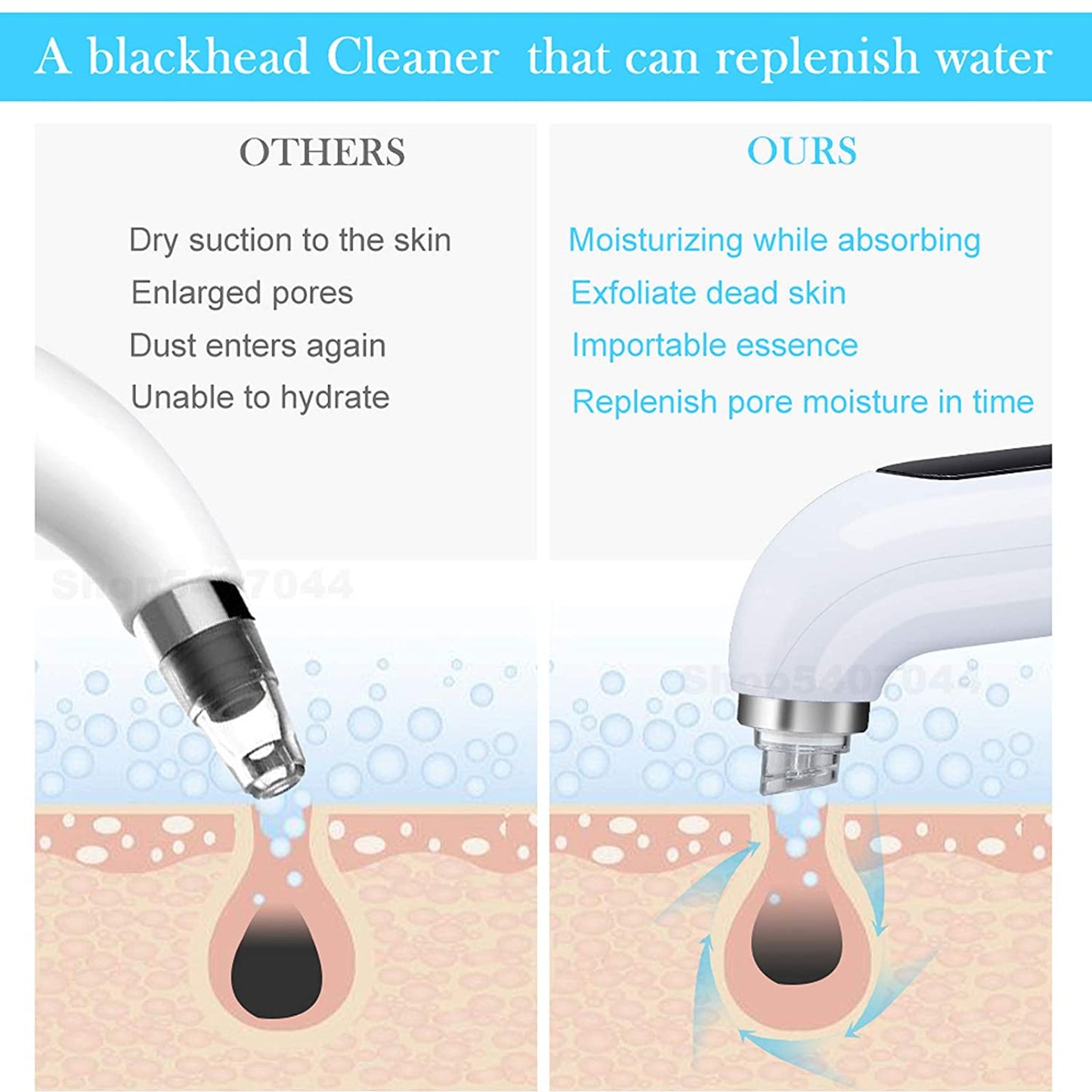 Blackhead Removal Tool