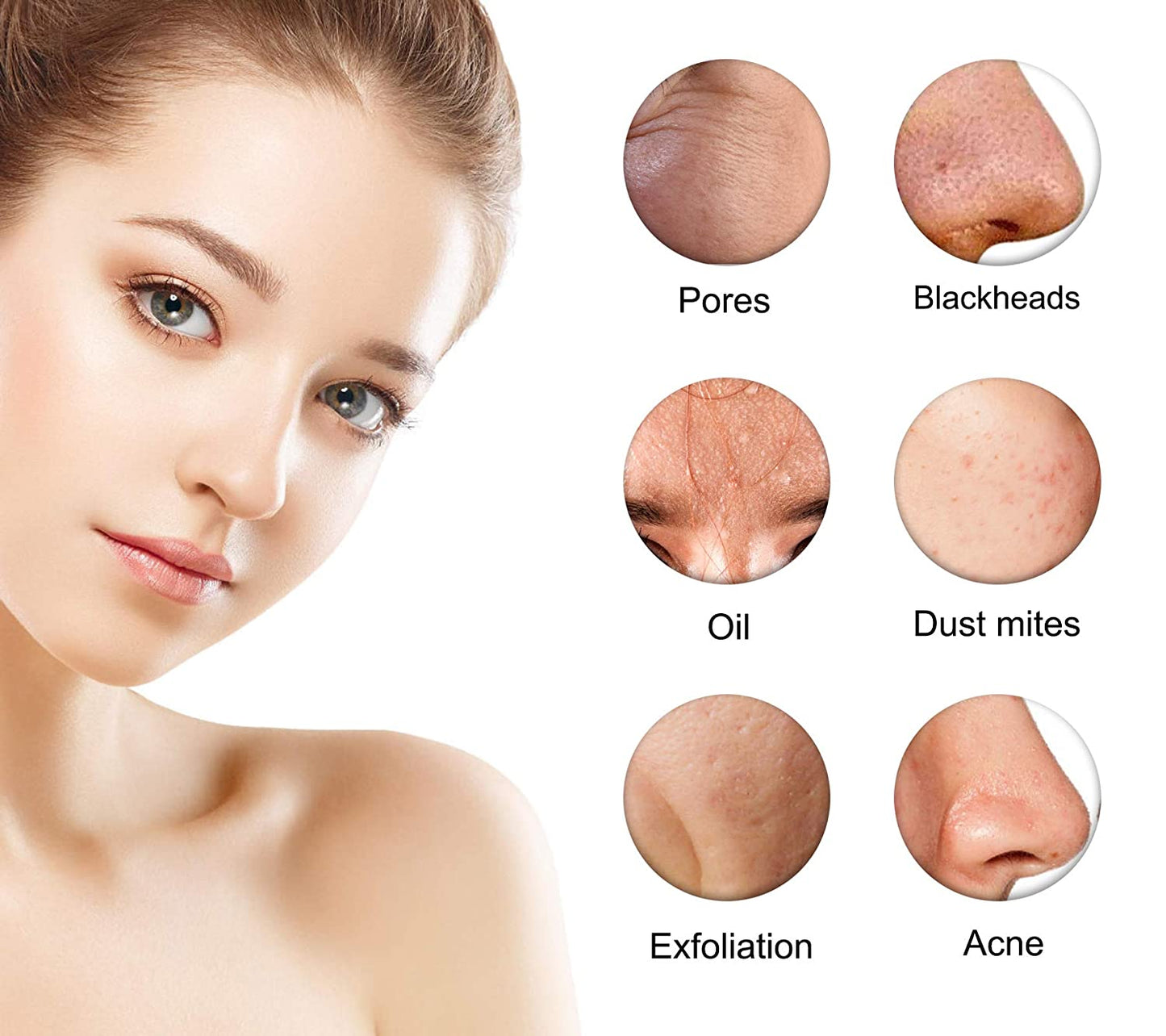 Blackhead Removal Tool