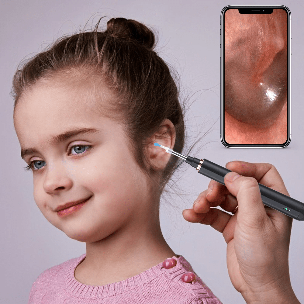 Ear Wax Removal Kit